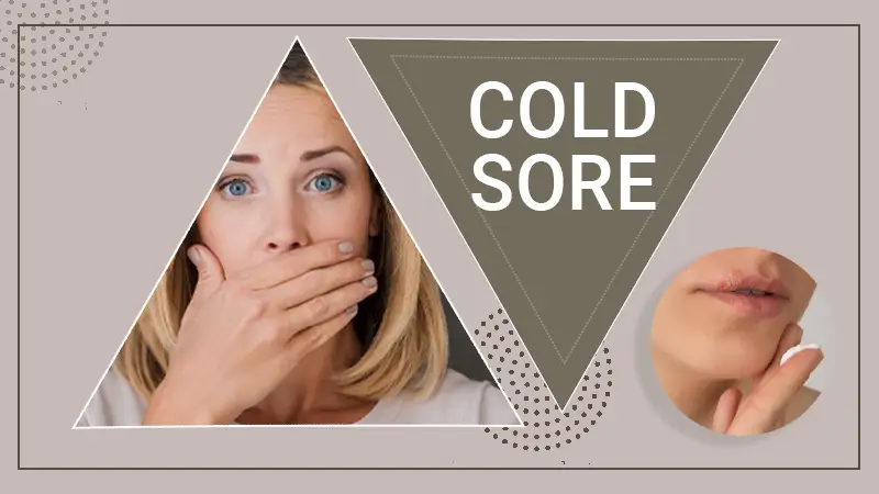 cold-sore
